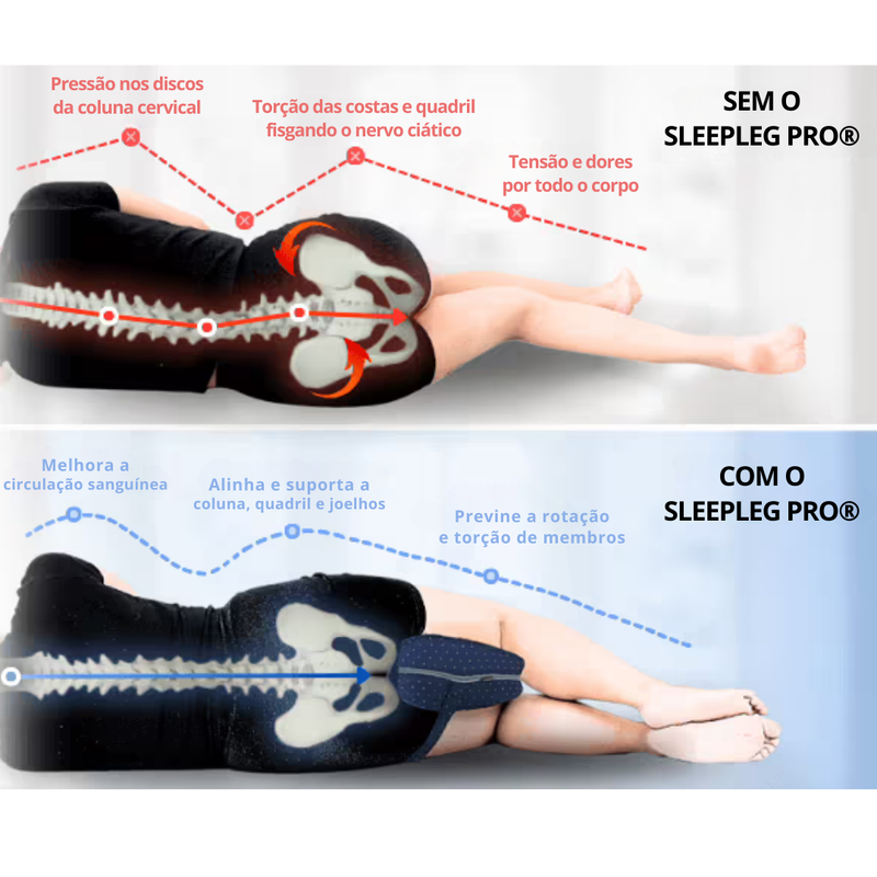 Travesseiro de Alinhamento - SleepLeg Pro®