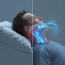 Protetor Bucal Anti-Ronco Znorex®